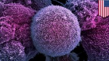 Sel-sel mati yang gagal bunuh diri dapat menyebarkan kanker - Tomonews