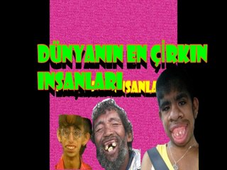 EN ÇİRKİN INSANLARI (world's uglıest people)