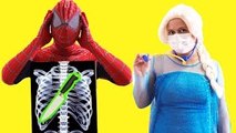 SPIDERMAN & FROZEN ELSA vs DOCTOR! Spiderman Eats a Knife and GETS SURGERY w/ Frozen Elsa