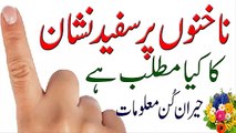 Nakhnon Per Sufaid Nishan Ka Kiya Matlab Hai in Urdu ناخنوں پر سفید نشان کا ہونا