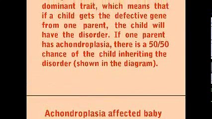 Symptoms of Achondroplasia - आकान्ड्रोप्लेसिया के लक्षण