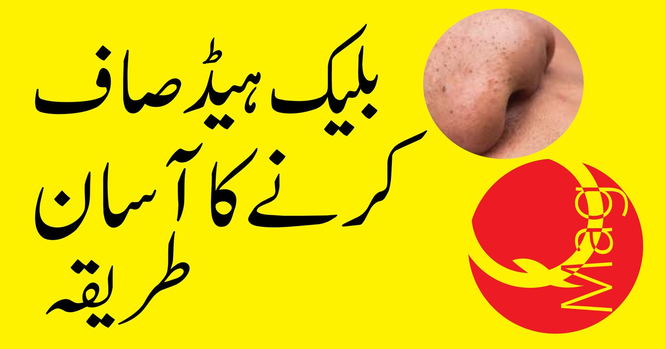 Blackheads Saf Karen Ka Tariqa by QMag
