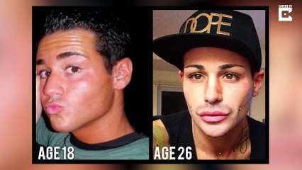 Il subit 100 opérations et crois être devenu le plus bel homme de la terre ...