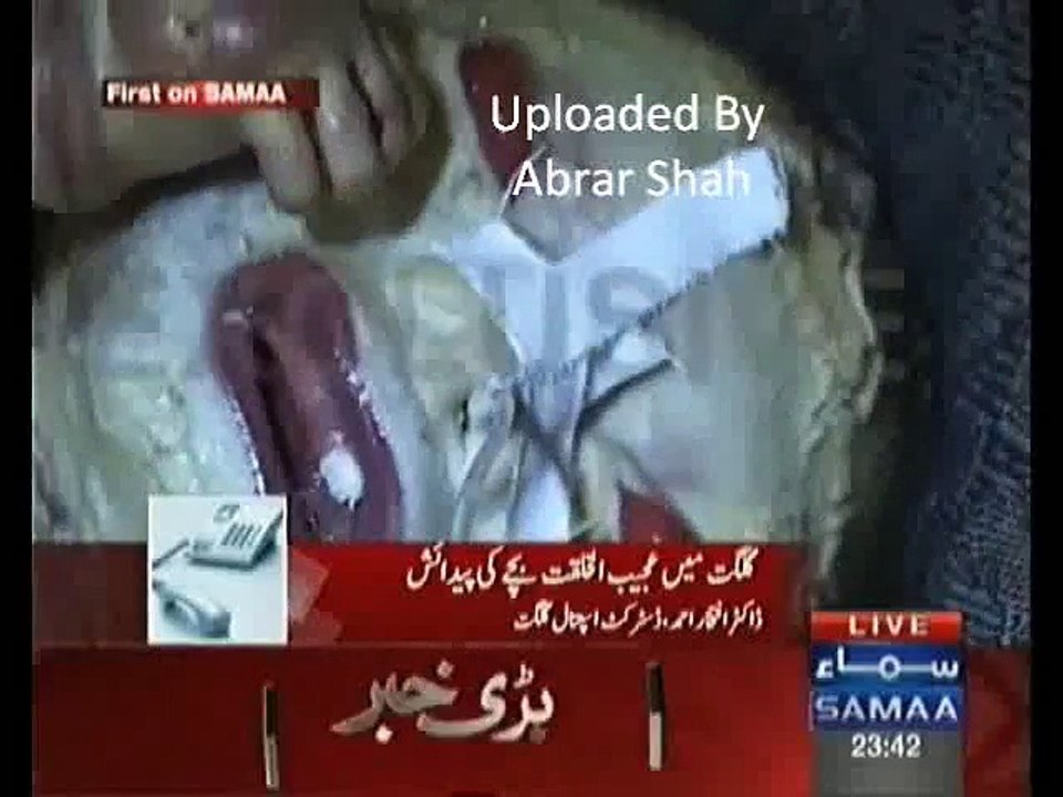 Baby Born With Problem In Pakistan Birth On Friday 15 12 2016 In Gilgit