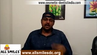 Best Smilemakeover in Bangalore - Cosmetic Dentist in Bangalore(1)
