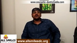 Best Smilemakeover in Bangalore - Cosmetic Dentist in Bangalore