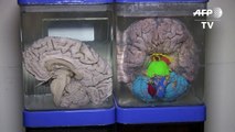 Insólito museo peruano invita a escudriñar el cerebro humano