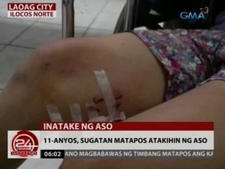 24 Oras: 11-anyos, sugatan matapos atakihin ng aso