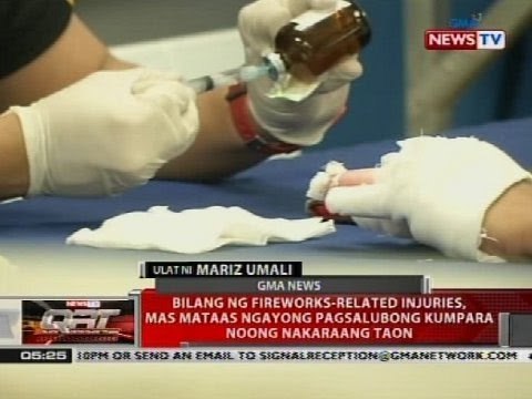 Bilang ng fireworks-related injuries mas mataas ngayong pagsalubong kumpara noong nakaraang taon