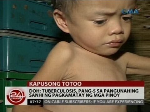 DOH: Tuberculosis, pang-5 sa pangunahing sanhi ng pagkamatay ng mga Pinoy