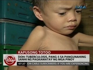 DOH: Tuberculosis, pang-5 sa pangunahing sanhi ng pagkamatay ng mga Pinoy
