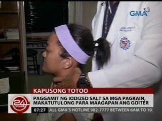 Paggamit ng iodized salt sa mga pagkain, makatutulong para maagapan ang goiter