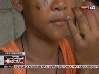 3 bata, sugatan matapos masabugan ng nasusunog na bote at lata sa basurahan