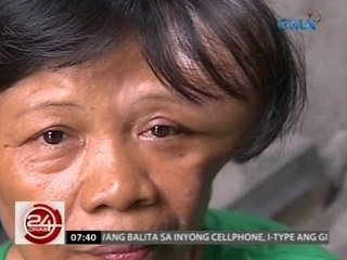 24 Oras: Ginang, pitong taon nang pinahihirapan ng bukol niya sa noo