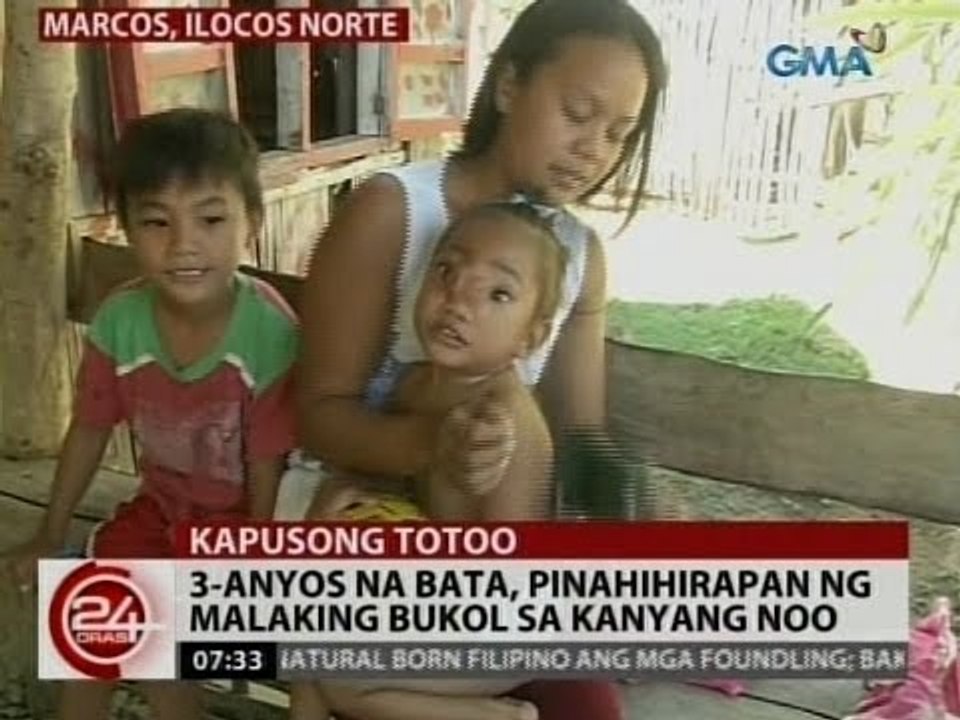 24 Oras: 3-anyos na bata, pinahihirapan ng malaking bukol sa kanyang noo