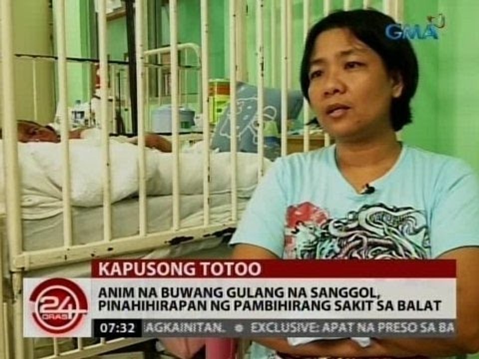 24 Oras: Anim na buwang gulang na sanggol, pinahihirapan ng pambihirang sakit sa balat