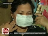 24 Oras: Iba't ibang sakit sa tag-init, maiiwasan sa tamang pangangalaga sa katawan