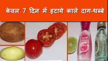 काले धब्बे दूर करने के लिए घरेलू उपचार - How to Remove Dark Spot on Face in Just 1 Week - BlackHeads