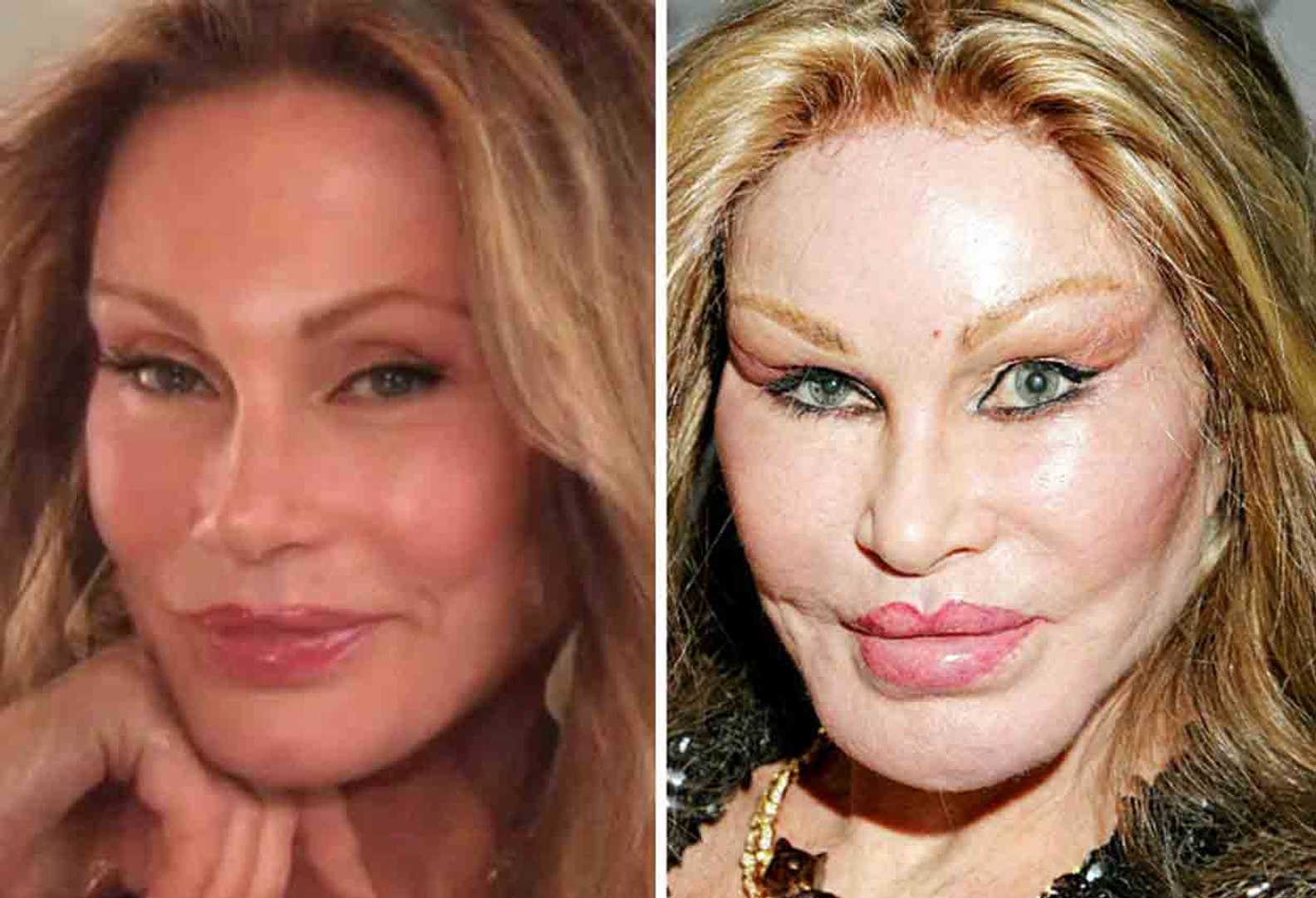 ⁣10 Worst Plastic Surgery Fails