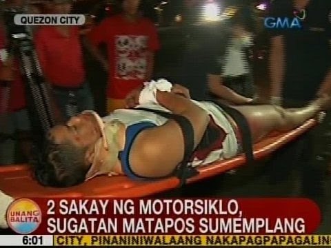 UB: 2 sakay ng motorsiklo, sugatan matapos sumemplang sa QC