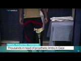 Israel-Palestine Tensions: Thousands in need of prosthetic limbs in Gaza