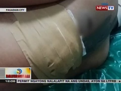 BT: Pulis, sugatan matapos pagtulungan ng apat na lasing; isa sa mga suspek, patay