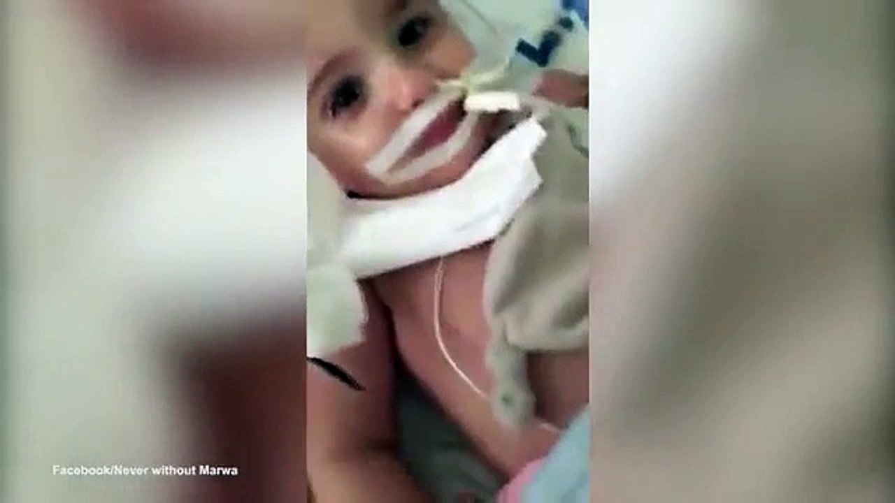 Mjekët donin t’ia fiknin aparatet njëvjeçares në koma, por në sekondat e fundit ndodhi mrekullia