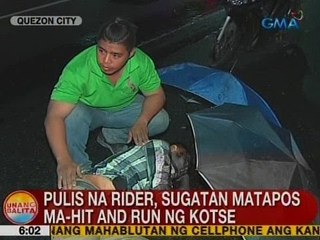 UB: Pulis na rider, sugatan matapos ma-hit and run ng kotse sa QC