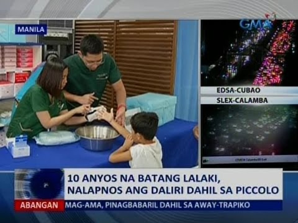 10-anyos na batang lalaki, nalapnos ang daliri dahil sa Piccolo
