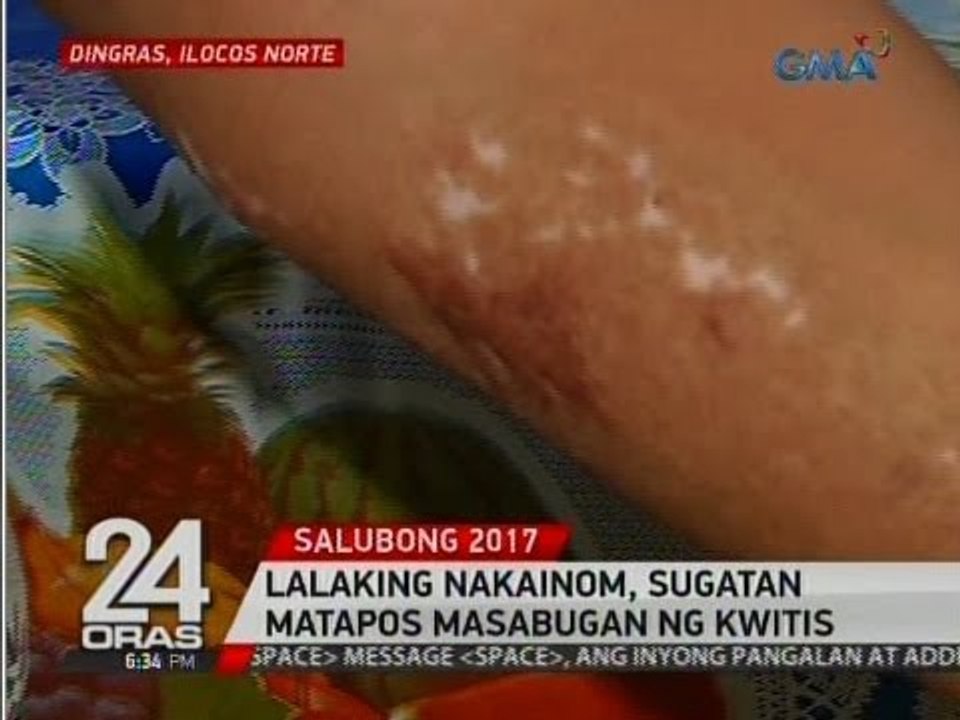 24 Oras: Lalaking nakainom, sugatan matapos masabugan ng kwitis