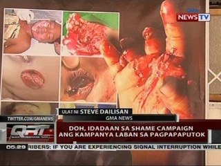 QRT: DOH, idadaan sa shame campaign ang kampanya laban sa pagpapaputok