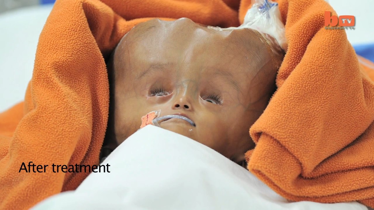 Are cel mare cap din lume!