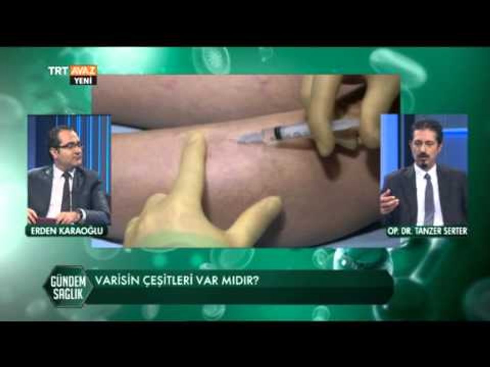 Varis Hastalığı ve Tedavisi - Gündem Sağlık - TRT Avaz