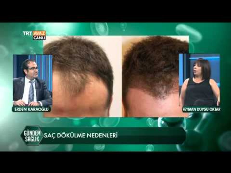 Saç Ekimi ve Saç Dökülme Nedenleri - Gündem Sağ...