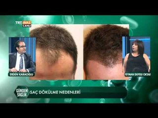 Saç Ekimi ve Saç Dökülme Nedenleri - Gündem Sağlık - TRT Avaz