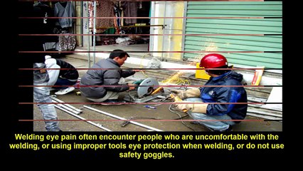Welding and cure sore eyes