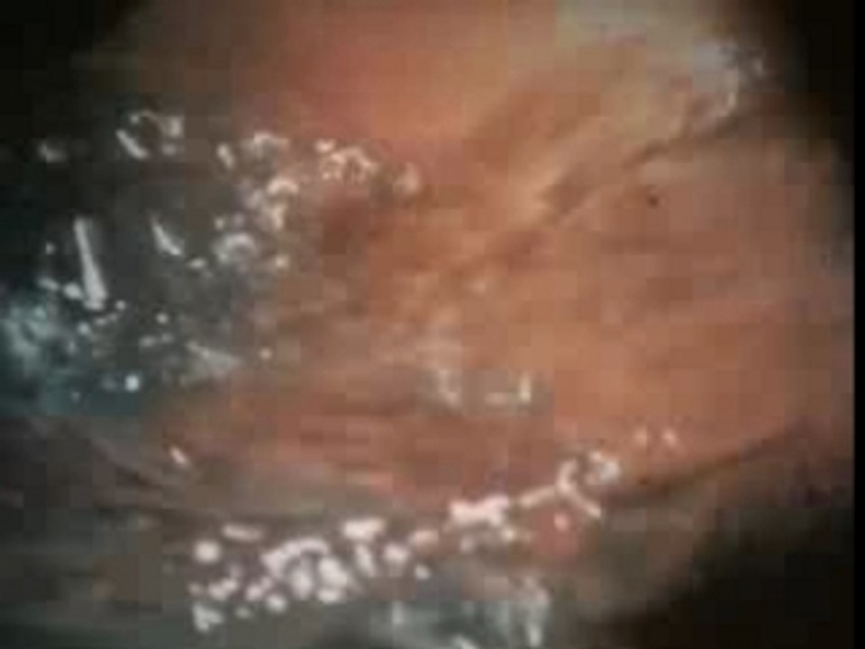 Corps dans l'eau