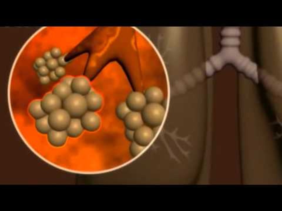 Gündem Sağlık - 26 Şubat 2016 Tanıtım - TRT Avaz