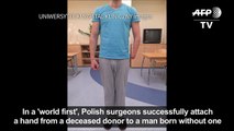 Polish surgeons succesfully attach hand to man born without one-P2uP5i2OR5M