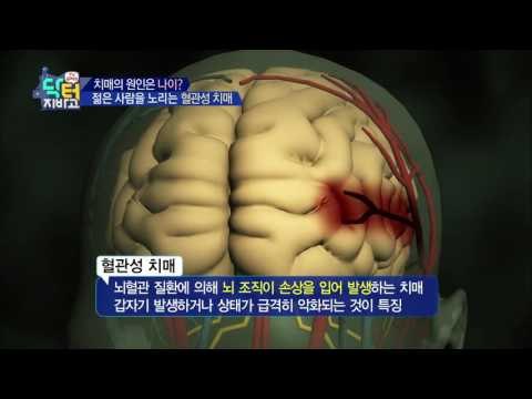 젊은 사람을 노리는 혈관성 치매?! 순식간에 치매 부르는 뇌졸중!