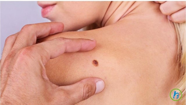 9 Health Symptoms Women Shouldn’t Ignore