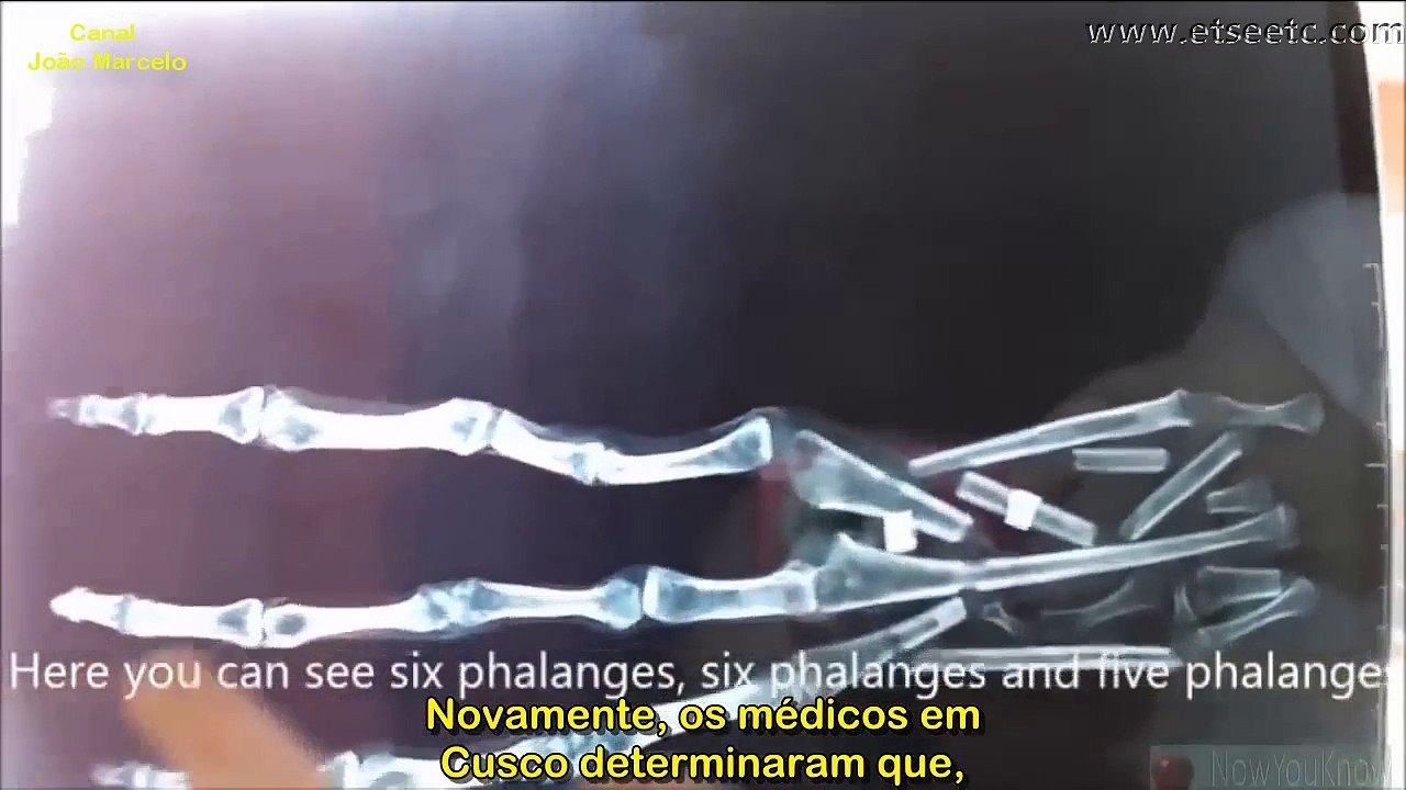 Mão Extraterrestre?