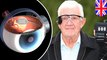 Bionic eye: UK blind patients to be fitted with bionic eye to restore partial eyesight - TomoNews