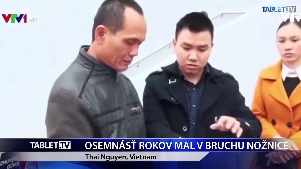 Vietnamcovi po 18 rokoch vyoperovali z brucha chirurgické nožnice