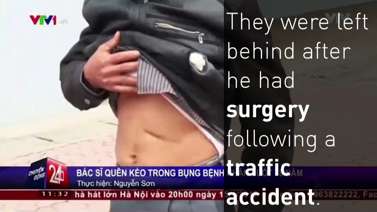 Scissors removed from man's stomach after 18 years