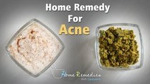 How To Get Rid Of Acne | Home Remedies with Upasana | Mind Body Soul