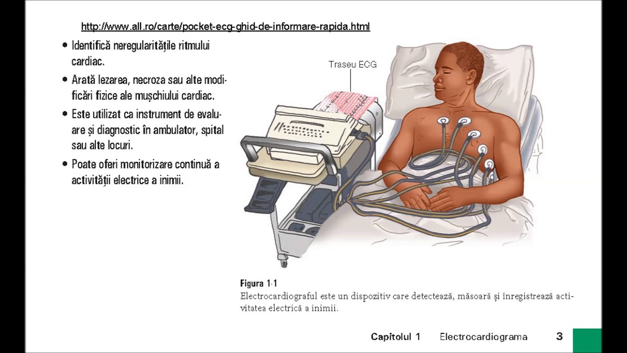 Pocket ECG Bruce Shade