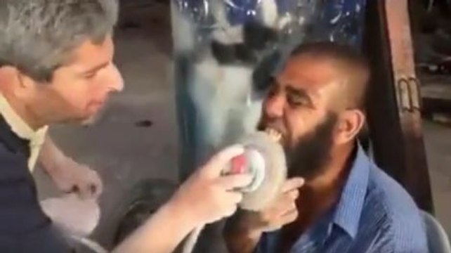 Blanchiment des dents à la polisseuse