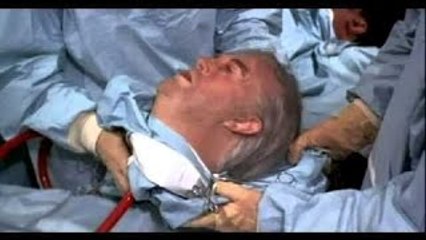 O Primeiro Transplante de Cabeça (Dublado) - Documentário Odisseia