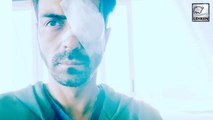 Arjun Rampal Suffers From Eye Injury